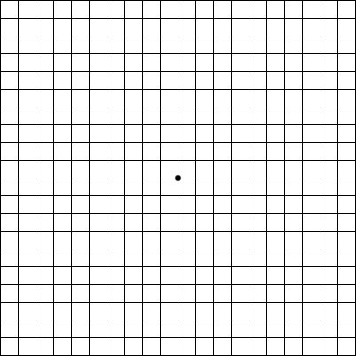 Amsler Grid Eye Test: What It Is, Types & Uses